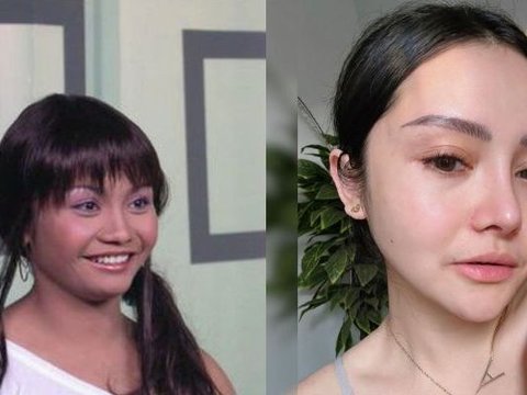 Terbaru Mahalini, Intip Transformasi Artis Sebelum dan Sesudah Lakukan Oplas Hidung, Bikin Pangling