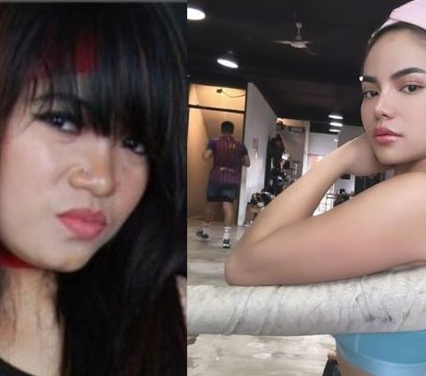 Terbaru Mahalini, Intip Transformasi Artis Sebelum dan Sesudah Lakukan Oplas Hidung, Bikin Pangling