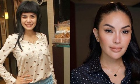 Terbaru Mahalini, Intip Transformasi Artis Sebelum dan Sesudah Lakukan Oplas Hidung, Bikin Pangling