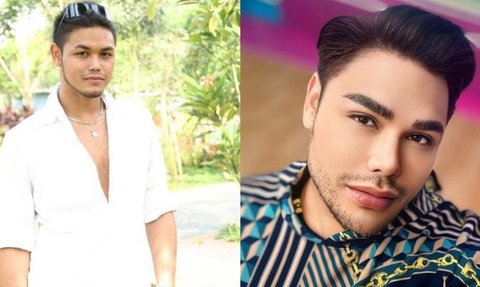 Terbaru Mahalini, Intip Transformasi Artis Sebelum dan Sesudah Lakukan Oplas Hidung, Bikin Pangling