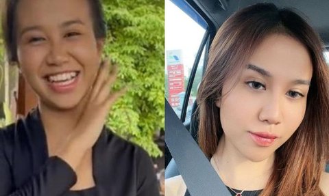 Terbaru Mahalini, Intip Transformasi Artis Sebelum dan Sesudah Lakukan Oplas Hidung, Bikin Pangling