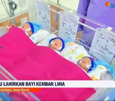 Facts about Mother in Indramayu Giving Birth to Quintuplets, Initially only 4 Babies in Ultrasound