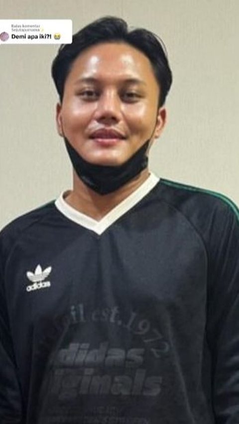 Rizky Febian Diduga Oplas Ikuti Jejak Mahalini, Hidungnya Jadi Sorotan