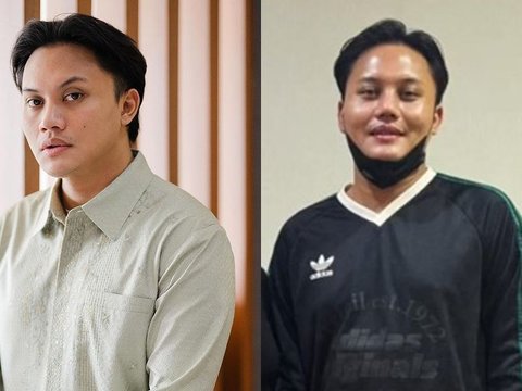 Rizky Febian Diduga Oplas Ikuti Jejak Mahalini, Hidungnya Jadi Sorotan