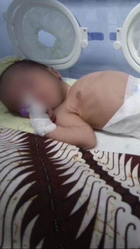 Kisah Pilu Bayi Baru Lahir Ditinggal Kabur Ayah, Sel Tubuhnya Digerogoti Bakteri Ganas Harus Dirawat di ICU<br>