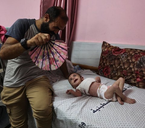 FOTO: Nestapa Anak-Anak Palestina Terpapar Penyakit Kulit Berbahaya karena Krisis Air Bersih di Jalur Gaza