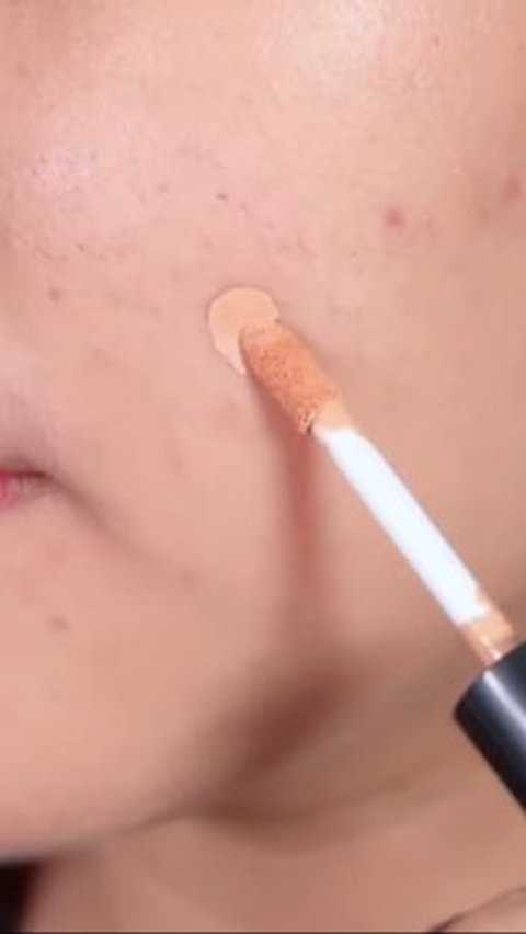 How to Use Concealer to Hide Acne, Make Your Face Look Smooth