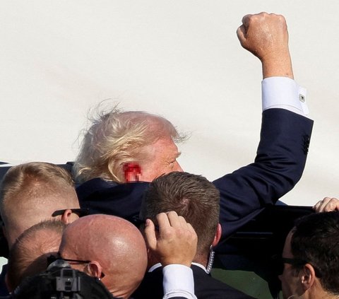 FOTO: Inilah Luka Donald Trump yang Tertembak saat Kampanye Pilpres Amerika Serikat