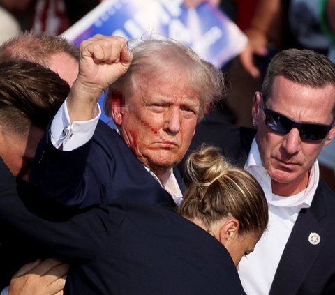 FOTO: Inilah Luka Donald Trump yang Tertembak saat Kampanye Pilpres Amerika Serikat