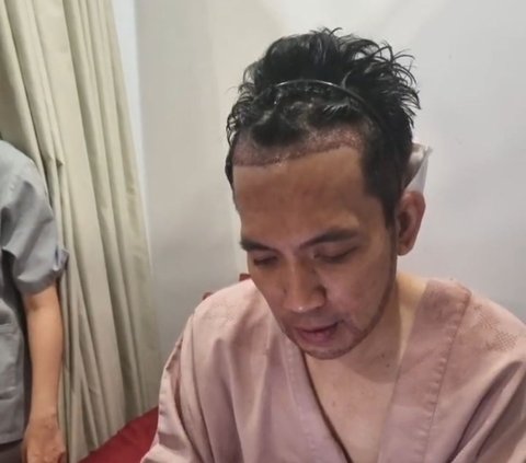 Bikin Pangling! 10 Potret Terbaru Desta Jalani Transplantasi Rambut di Klinik Tompi, Bakal Tampil Brewokan