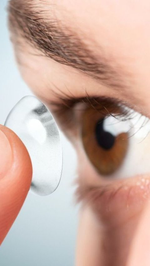 Pentingnya Merawat Softlens untuk Cegah Infeksi Kornea Mata, Begini Tips dari Dokter