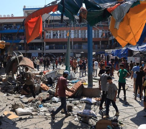 FOTO: Nestapa Anak-Anak Terluka Akibat Serangan Israel di Kamp Pengungsian Jalur Gaza, Ada yang Diperban Sekujur Tubuh