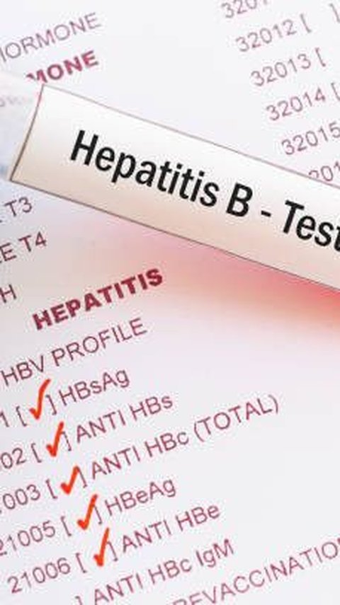<br>IDAI Ungkap 10 Anak Sudah Kena Hepatitis B di Sumut, Khawatir seperti Gunung Es