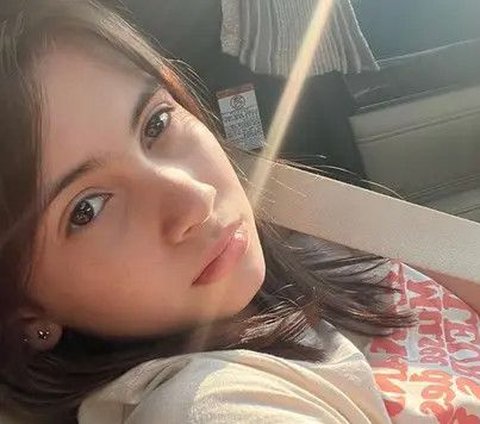 Potret Richelle Skornicki Adik Sandrinna Michelle Tampil Bare Face, Tetap Cantik dan Percaya dengan Freckles