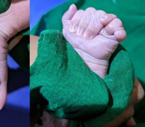 Furore Over Baby Born with 25 Fingers, Considered the Reincarnation of a Goddess