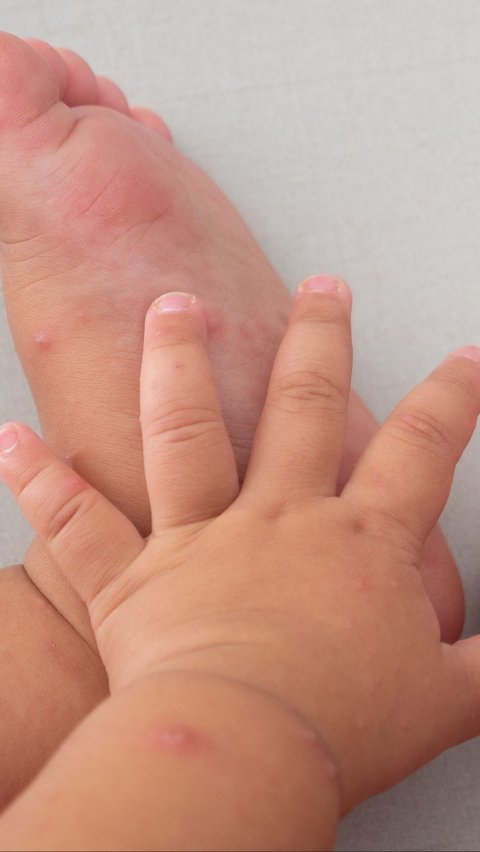 Furore Over Baby Born with 25 Fingers, Considered the Reincarnation of a Goddess