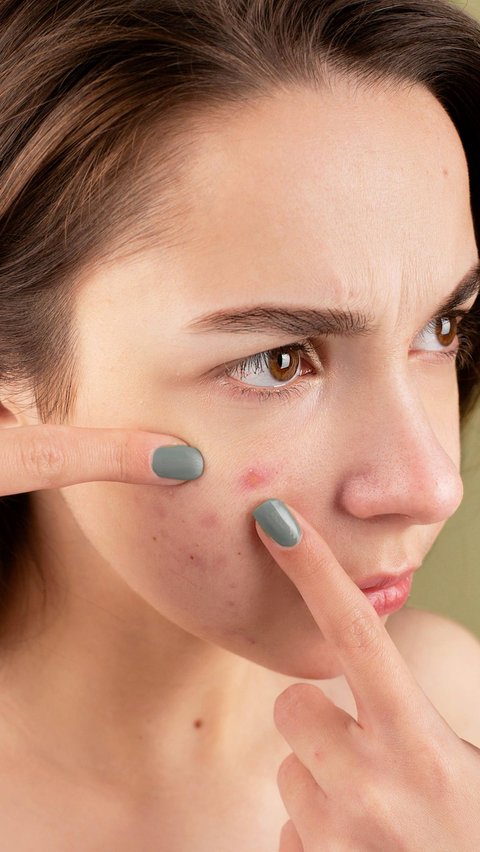 Prayer to Remove Acne and Boils, A Must-Know Acne Fighter!