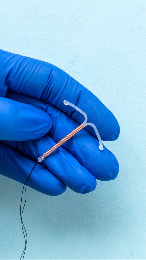 Terrifying, Contraceptive Device Lost for 12 Years and Found in Large Intestine