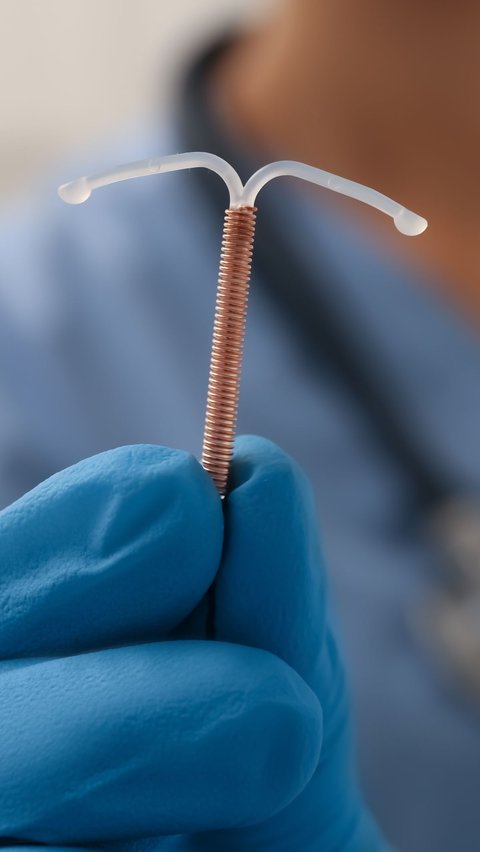 Terrifying, Contraceptive Device Lost for 12 Years and Found in Large Intestine