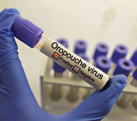 Facts About the Oropouche Virus That Panic Brazil, Symptoms Similar to Dengue Fever