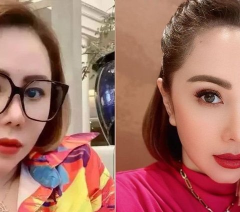 Kembali Muda Bak ABG, 9 Potret Transformasi Artis Indonesia Sebelum & Sesudah Face Lifting