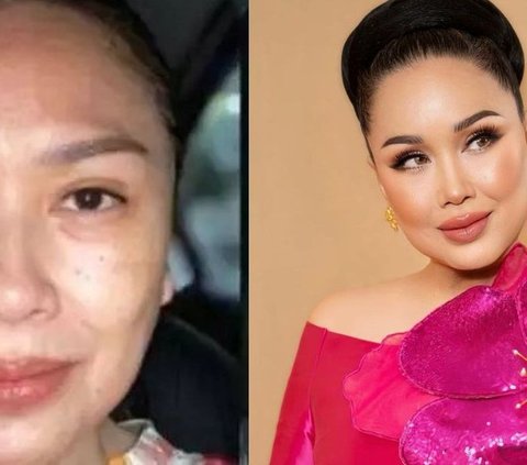 Kembali Muda Bak ABG, 9 Potret Transformasi Artis Indonesia Sebelum & Sesudah Face Lifting