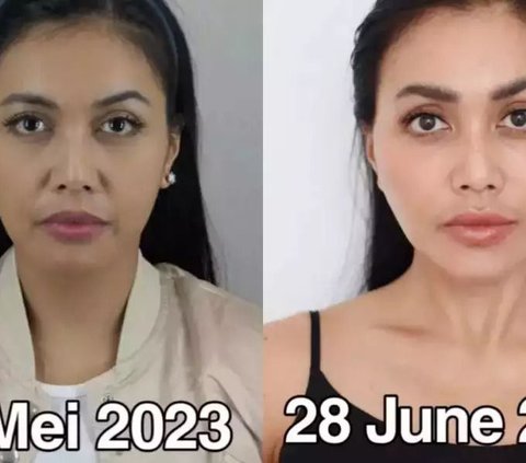 Kembali Muda Bak ABG, 9 Potret Transformasi Artis Indonesia Sebelum & Sesudah Face Lifting