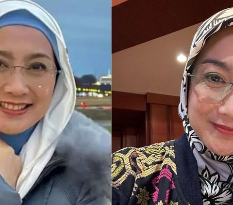 Kembali Muda Bak ABG, 9 Potret Transformasi Artis Indonesia Sebelum & Sesudah Face Lifting