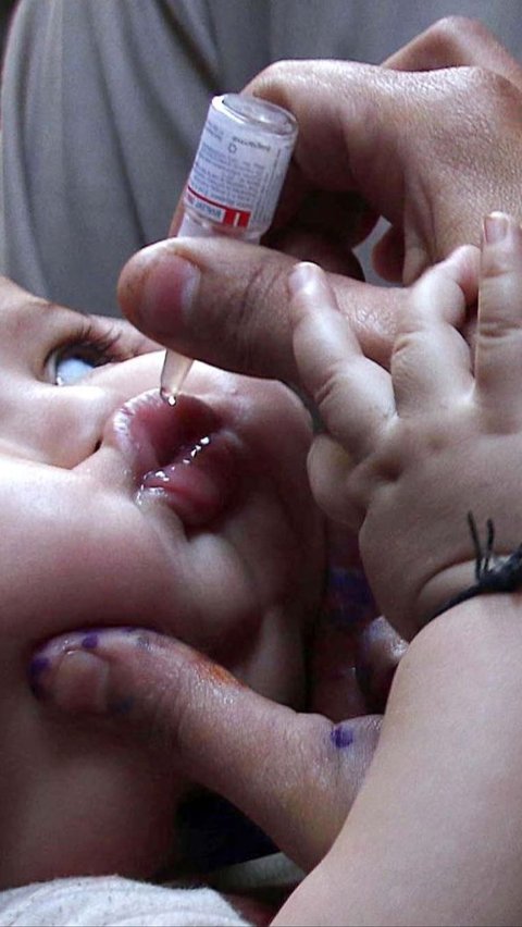 Fakta dan Mitos Tentang Polio yang Wajib Diketahui