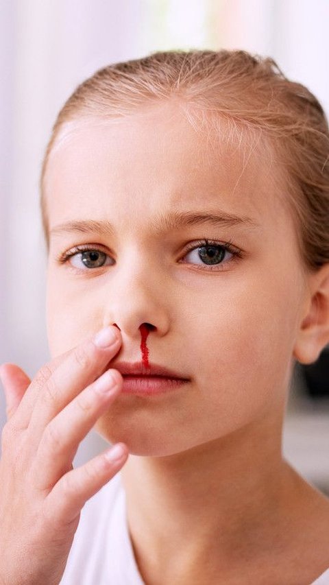 Ilustrasi Mimisan (sumber: iStockphoto)