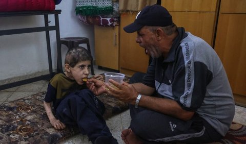 <b>PBB: 50.000 Anak Gaza Butuh Perawatan karena Kekurangan Giz</b>