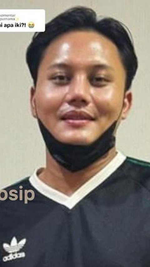 Tak Hanya Mahalini Raharja, Potret Terbaru Rizky Febian yang Juga Diduga Jalani Operasi Plastik di Korea Selatan