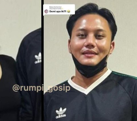 Tak Hanya Mahalini Raharja, Potret Terbaru Rizky Febian yang Juga Diduga Jalani Operasi Plastik di Korea Selatan