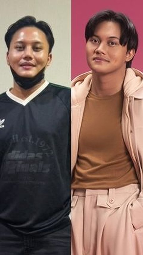 10 Artists Before VS After Plastic Surgery in 2024, Mahalini Raharja & Rizky Febian Get Criticized