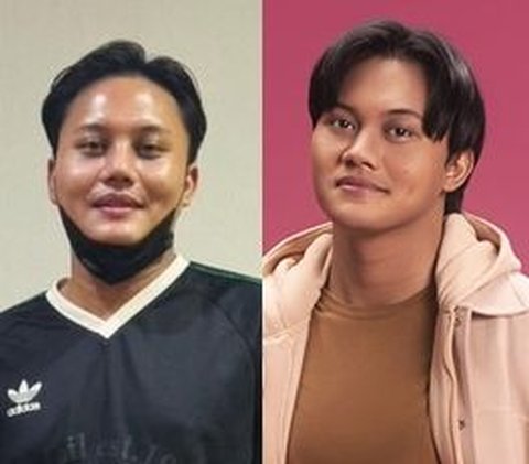 10 Artists Before VS After Plastic Surgery in 2024, Mahalini Raharja & Rizky Febian Instead Get Mocked