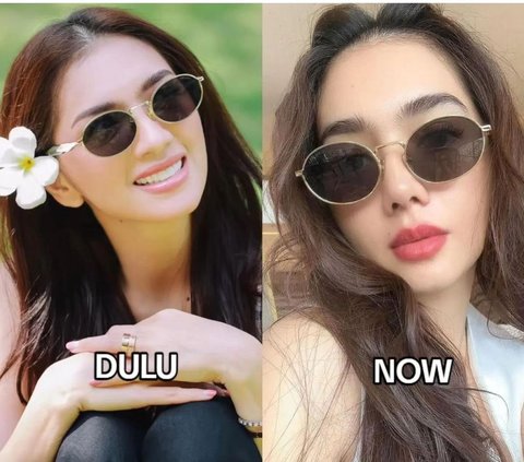 10 Artists Before VS After Plastic Surgery in 2024, Mahalini Raharja & Rizky Febian Instead Get Mocked