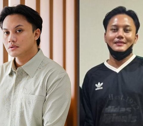 10 Artists Before VS After Plastic Surgery in 2024, Mahalini Raharja & Rizky Febian Instead Get Mocked