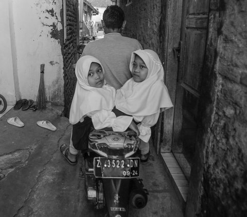 FOTO CERITA: Semangat Anak Kembar Siam Asal Garut, Bercita-cita Jadi Dokter