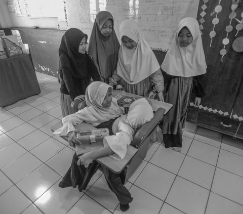 FOTO CERITA: Semangat Anak Kembar Siam Asal Garut, Bercita-cita Jadi Dokter