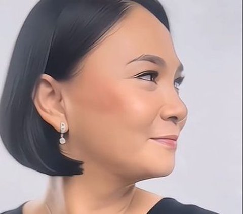 Potret Terbaru Dian Nitami Usai Sebulan Operasi Face Lifting, Hasilnya Natural Jadi Lebih Cantik & Awet Muda