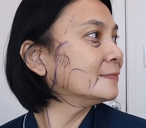 Potret Wajah Dian Nitami Sebulan Pasca Face Lifting: Kulit Kencang dan Hasil Natural.