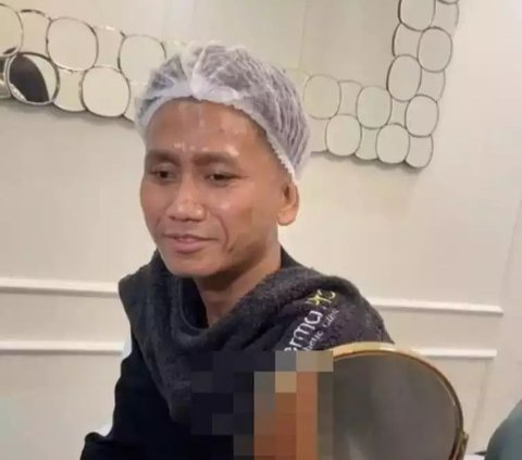 9 Photos of Pegi Setiawan Getting More 'Glowing' After Becoming a TikTok Celebrity, Regular Treatments at a Beauty Clinic