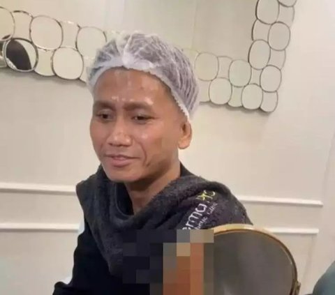 9 Photos of Pegi Setiawan Getting More 'Glowing' After Becoming a TikTok Celebrity, Regular Treatments at a Beauty Clinic