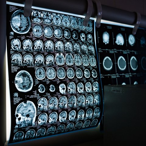ct scan