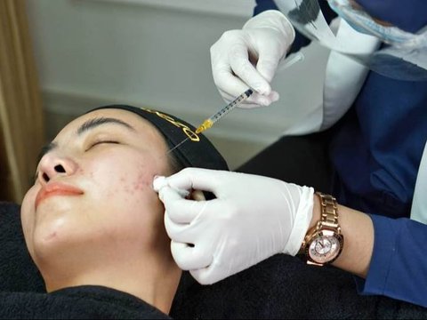 Apakah Peeling Wajah Efektif Menghilangkan Flek Hitam?