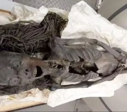 Revealed! The Medical Cause of the 'Screaming Woman' Mummy