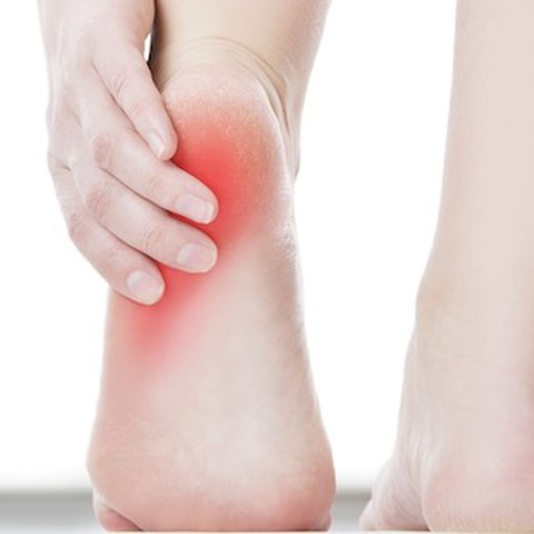 plantar fasciitis