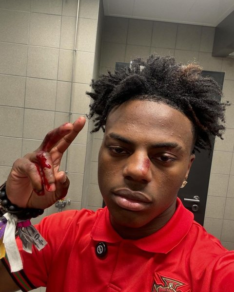 Deretan Fakta iShowSpeed, YouTuber Amerika yang Ramai Disorot saat Datang Ke Tanah Air