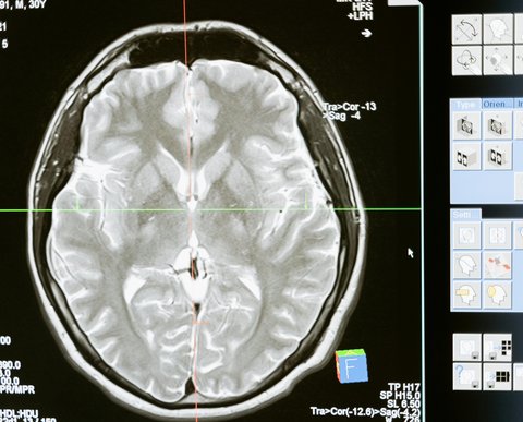 Penyebab Cognitive Dissonance