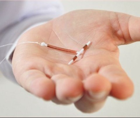 Jenis&ndash;jenis Kontrasepsi IUD